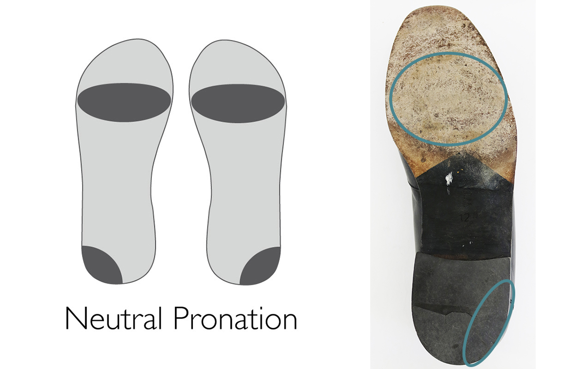 What Are The Bottoms Of Your Shoes Telling You? Ohio State Health ...